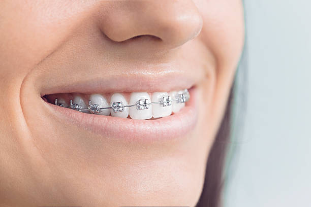 Best Tooth Extraction  in Mineral Wells, TX